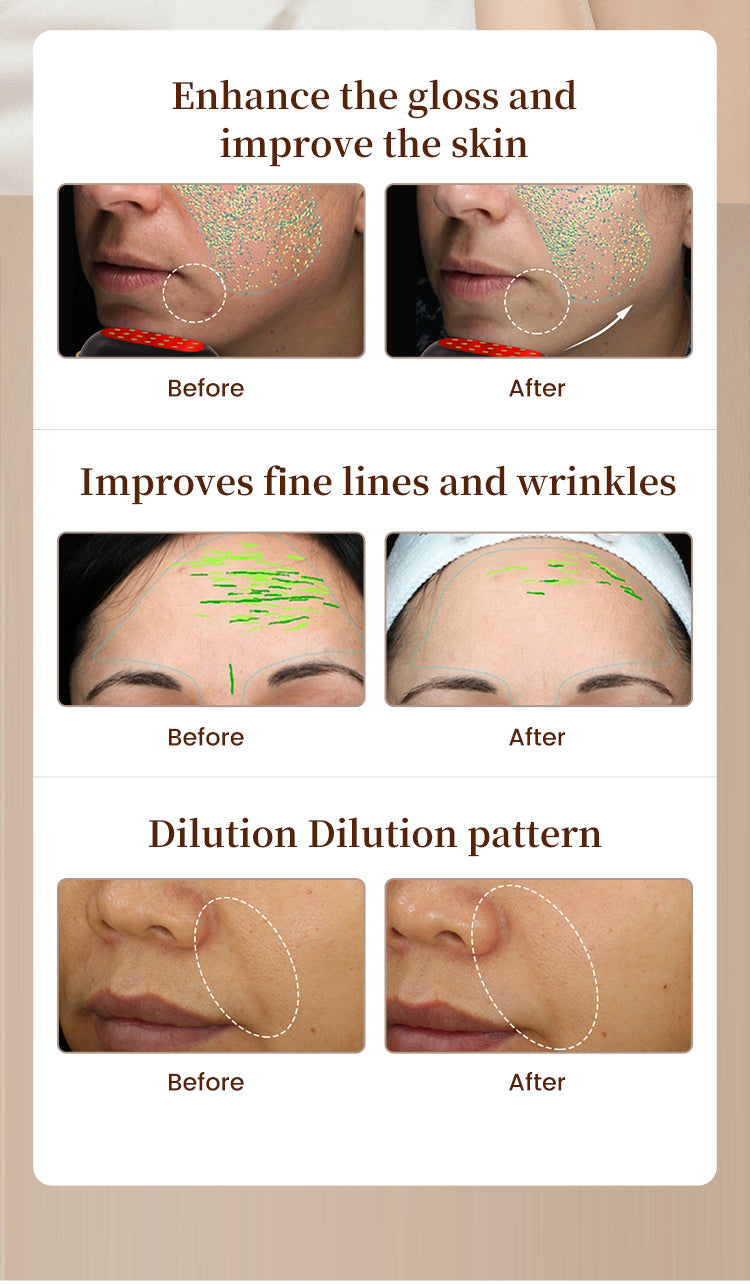 RadiaVita RF+EMS Red Light Face Lifting & Skin Rejuvenation Device