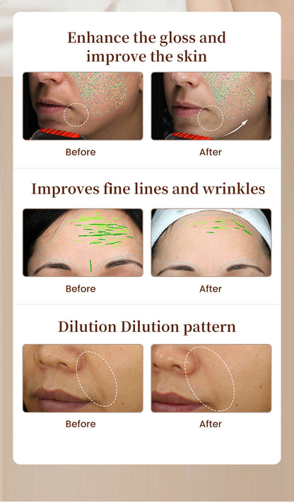 RadiaVita RF+EMS Red Light Face Lifting & Skin Rejuvenation Device