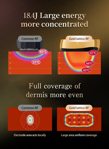 RadiaVita RF+EMS Red Light Face Lifting & Skin Rejuvenation Device